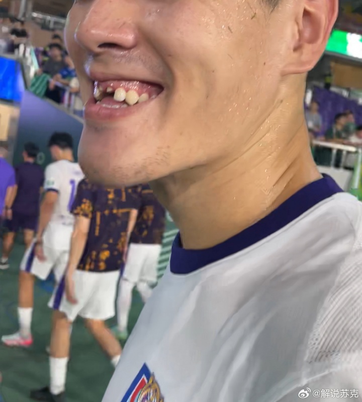 津门虎0-2负浙江遭遇失利，中卫王献钧拼抢中门牙遭撞击脱落